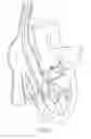 Fig. 08 - Catheter-based heart support system and method of implanting thereof