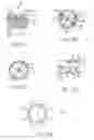Fig. 11 - Catheter-based heart support system and method of implanting thereof