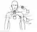Fig. 01 - Heart assist system and/or device
