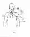 Fig. 02 - Heart assist system and/or device