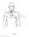 Fig. 15 - Heart assist system and/or device