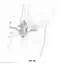 Fig. 10 - Vascular access ports and related methods