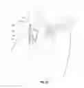 Fig. 13 - Vascular access ports and related methods