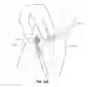 Fig. 14 - Vascular access ports and related methods
