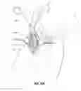 Fig. 15 - Vascular access ports and related methods