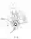 Fig. 18 - Vascular access ports and related methods