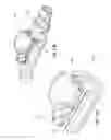 Fig. 33 - Vascular access ports and related methods