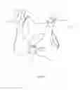Fig. 07 - WEARABLE INTRAVENOUS FLUID DELIVERY SYSTEM
