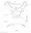 Fig. 13 - WEARABLE INTRAVENOUS FLUID DELIVERY SYSTEM