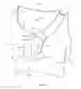 Fig. 14 - WEARABLE INTRAVENOUS FLUID DELIVERY SYSTEM