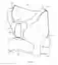 Fig. 15 - WEARABLE INTRAVENOUS FLUID DELIVERY SYSTEM