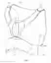 Fig. 16 - WEARABLE INTRAVENOUS FLUID DELIVERY SYSTEM