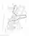 Fig. 02 - Respiratory therapy apparatus