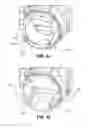 Fig. 17 - Outlet connection assembly and method of making the same