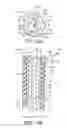 Fig. 04 - Catheter