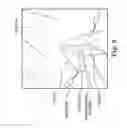 Fig. 10 - Method of dissecting tissue