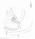 Fig. 08 - Biliary access catheter system and methods for accessing the biliary tree