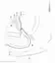 Fig. 10 - Biliary access catheter system and methods for accessing the biliary tree
