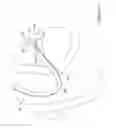 Fig. 11 - Biliary access catheter system and methods for accessing the biliary tree