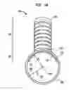 Fig. 05 - Delivery system for implantable flow connector