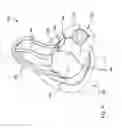 Fig. 10 - ANTISEPTIC APPLICATOR