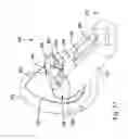 Fig. 18 - ANTISEPTIC APPLICATOR