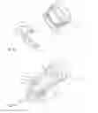 Fig. 08 - NEEDLEFREE VALVE DEVICE