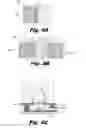 Fig. 05 - Asymmetric cochlear implant electrodes and method