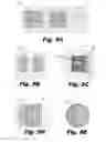 Fig. 06 - Asymmetric cochlear implant electrodes and method