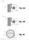 Fig. 10 - Implantable leads with flag extensions