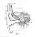 Fig. 02 - Cochlear implant fitting via efferent nerve fibers