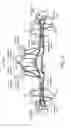 Fig. 04 - Cochlear implant fitting via efferent nerve fibers