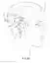 Fig. 06 - Implanted auditory prosthesis control by component movement