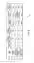Fig. 10 - Implanted auditory prosthesis control by component movement