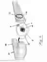 Fig. 03 - Extraocular epiretinal implant