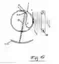 Fig. 07 - Extraocular epiretinal implant