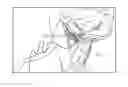 Fig. 01 - Method for adjusting a system for stimulating a hypoglossal nerve