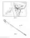 Fig. 02 - Method for adjusting a system for stimulating a hypoglossal nerve