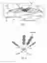 Fig. 02 - Spinal cord stimulation with interferential current