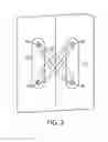 Fig. 03 - Spinal cord stimulation with interferential current