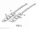 Fig. 04 - Spinal cord stimulation with interferential current