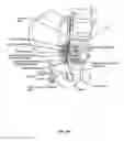 Fig. 04 - Attachment devices and associated methods of use with a nerve stimulation charging device