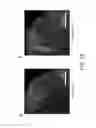 Fig. 17 - Compositions and methods for controlling pain