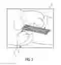 Fig. 04 - High-dose rate brachytherapy system