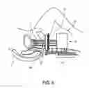 Fig. 05 - High-dose rate brachytherapy system