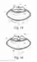Fig. 09 - System and method for a game racquet including a grommet actuator
