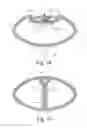 Fig. 11 - System and method for a game racquet including a grommet actuator