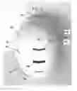 Fig. 03 - Liner assembly for a protective helmet