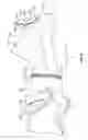 Fig. 05 - Debris bag with detachable collar