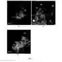 Fig. 02 - Use of lanthanide oxides to reduce sintering of catalysts